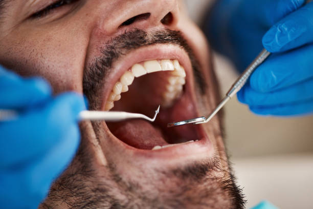 Best Walk-In Emergency Dentist in Oildale, CA